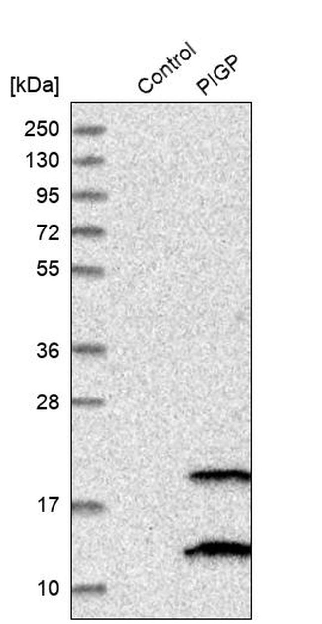 PIGP Antibody in Western Blot (WB)