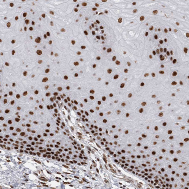 EYA2 Antibody in Immunohistochemistry (IHC)