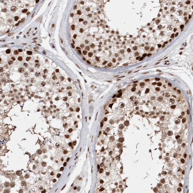 EYA2 Antibody in Immunohistochemistry (IHC)