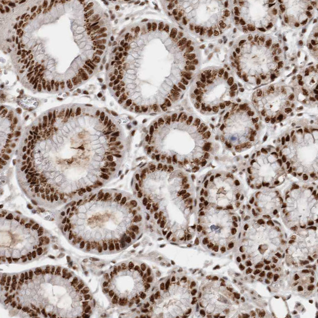 EYA2 Antibody in Immunohistochemistry (IHC)