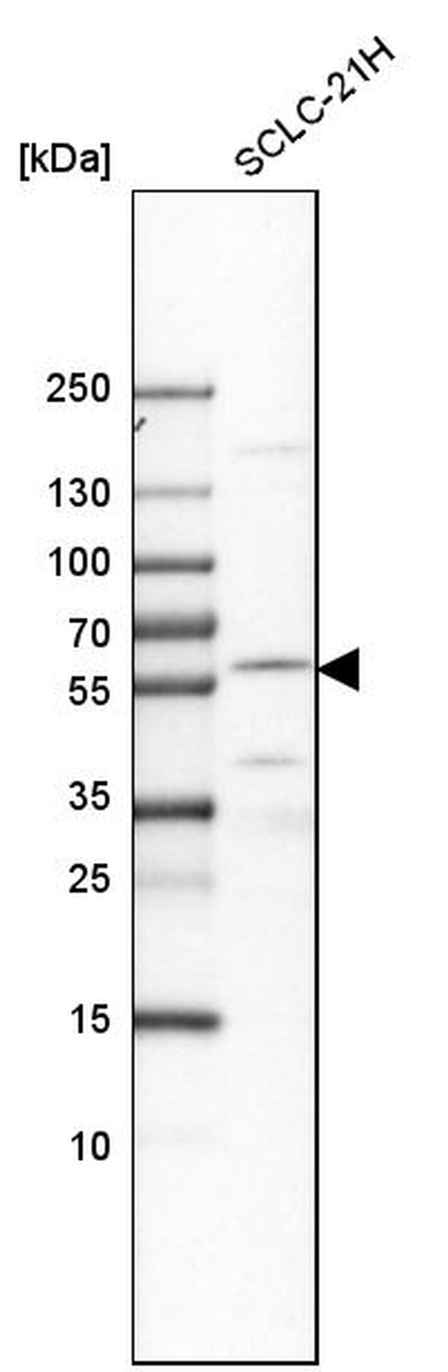 EYA2 Antibody in Western Blot (WB)