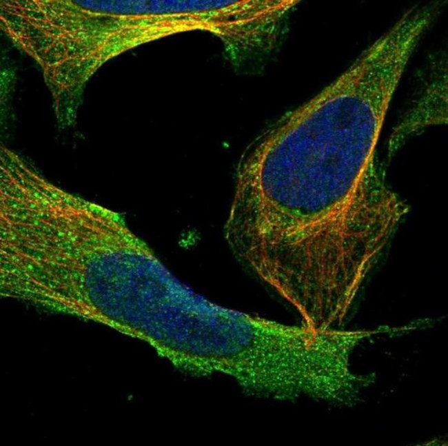 Caspase 14 Antibody in Immunocytochemistry (ICC/IF)