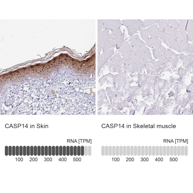 Caspase 14 Antibody in Immunohistochemistry (IHC)