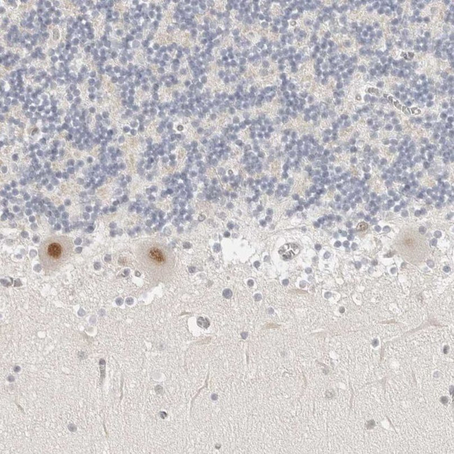 TSEN2 Antibody in Immunohistochemistry (IHC)