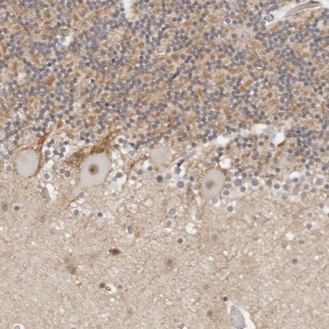 TSEN2 Antibody in Immunohistochemistry (IHC)