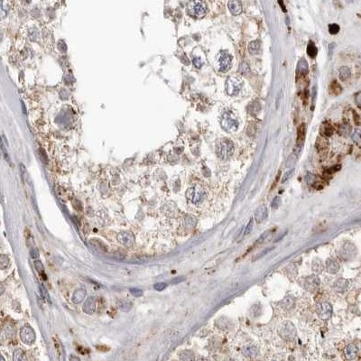 NUP43 Antibody in Immunohistochemistry (IHC)