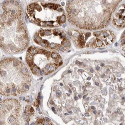 NUP43 Antibody in Immunohistochemistry (IHC)