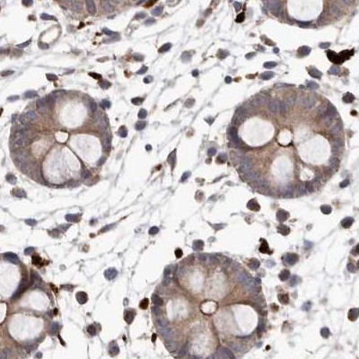 NUP43 Antibody in Immunohistochemistry (IHC)