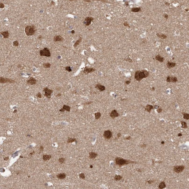 NUP43 Antibody in Immunohistochemistry (IHC)