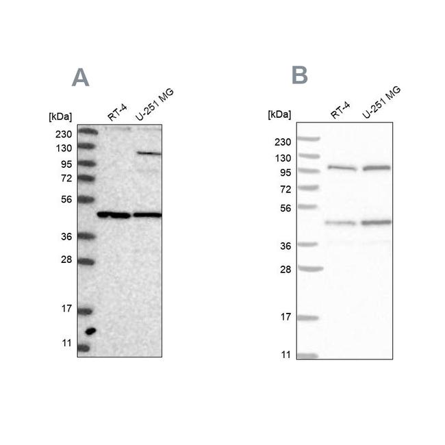 NUP43 Antibody in Western Blot (WB)