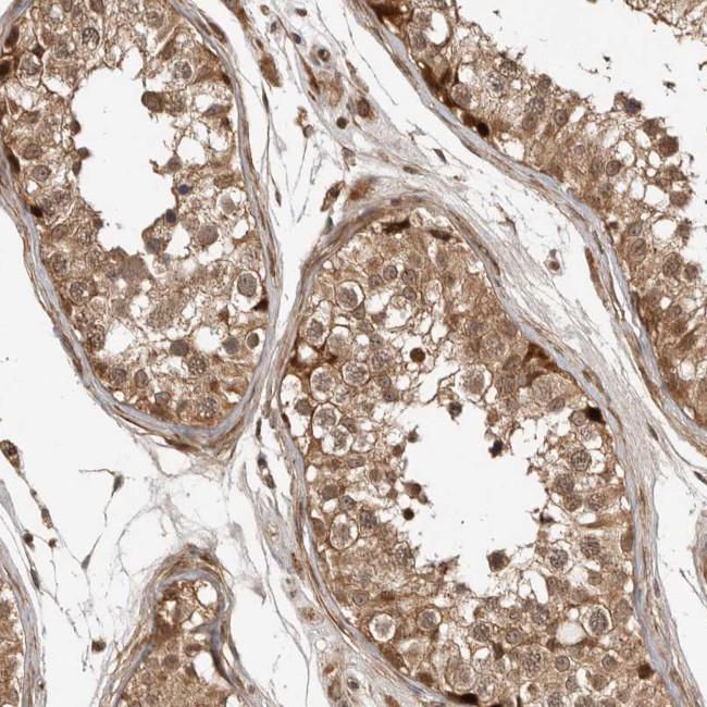 ADPRHL2 Antibody in Immunohistochemistry (IHC)