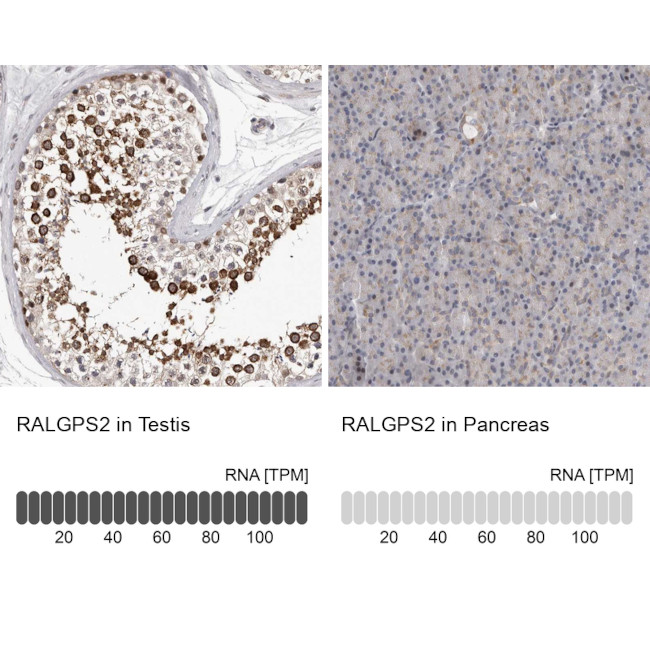 RALGPS2 Antibody in Immunohistochemistry (IHC)