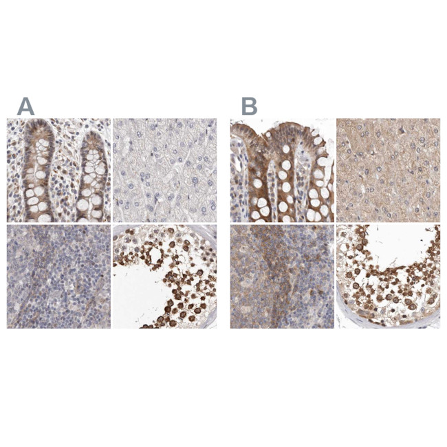 RALGPS2 Antibody in Immunohistochemistry (IHC)