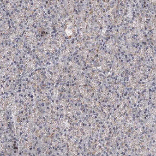 RALGPS2 Antibody in Immunohistochemistry (IHC)