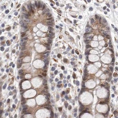 RALGPS2 Antibody in Immunohistochemistry (IHC)