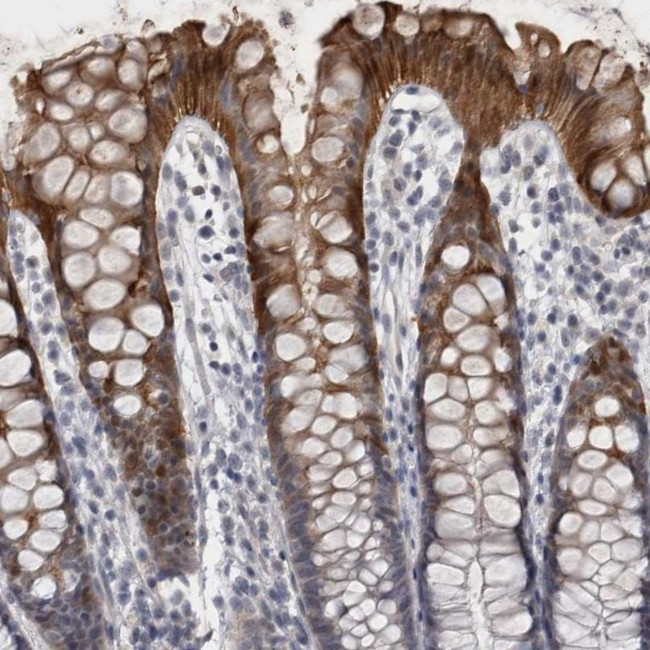 IFI44 Antibody in Immunohistochemistry (IHC)