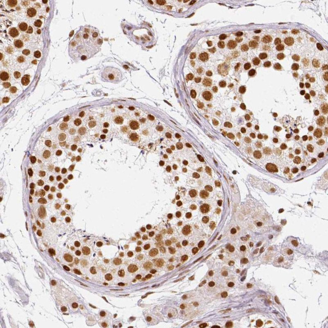 KDM5B Antibody in Immunohistochemistry (IHC)