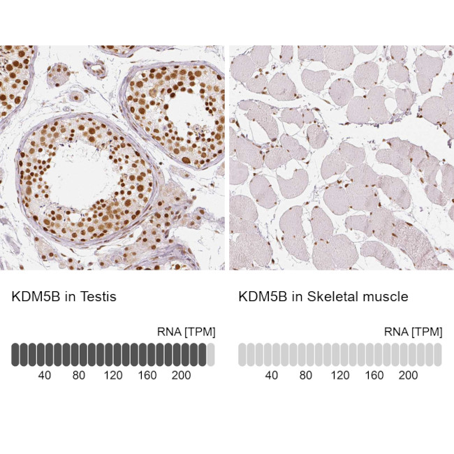 KDM5B Antibody