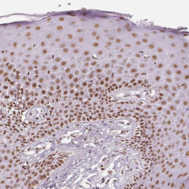 KDM5B Antibody in Immunohistochemistry (IHC)