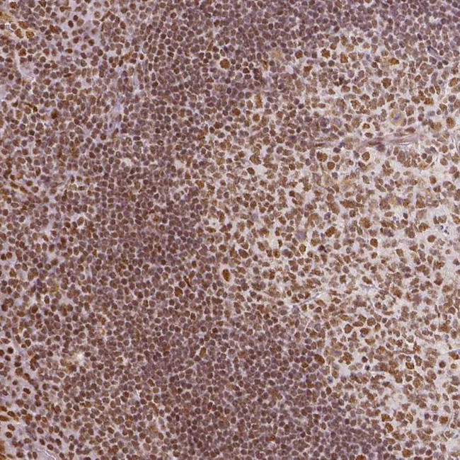 KDM5B Antibody in Immunohistochemistry (IHC)