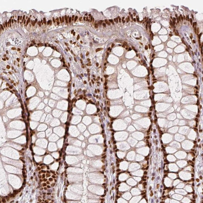 KDM5B Antibody in Immunohistochemistry (IHC)