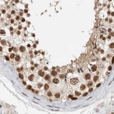 ZNF830 Antibody in Immunohistochemistry (IHC)