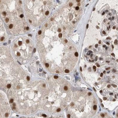 ZNF830 Antibody in Immunohistochemistry (IHC)