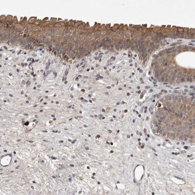 UBE3D Antibody in Immunohistochemistry (IHC)