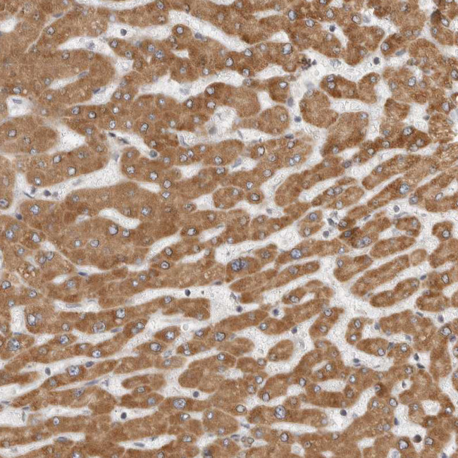 Lass2 Antibody in Immunohistochemistry (IHC)