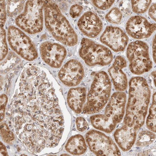 Lass2 Antibody in Immunohistochemistry (IHC)