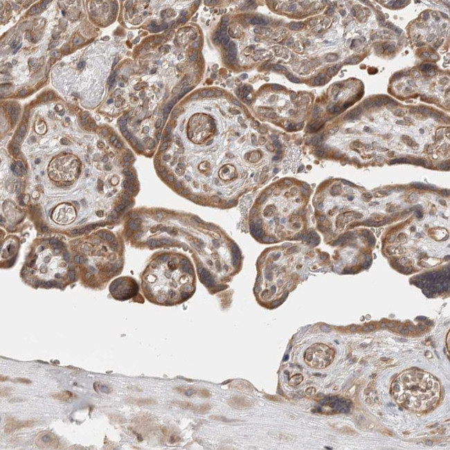 Lass2 Antibody in Immunohistochemistry (IHC)