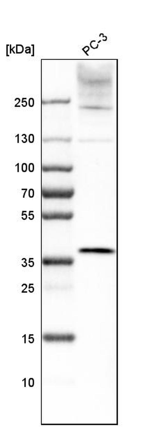 Lass2 Antibody in Western Blot (WB)