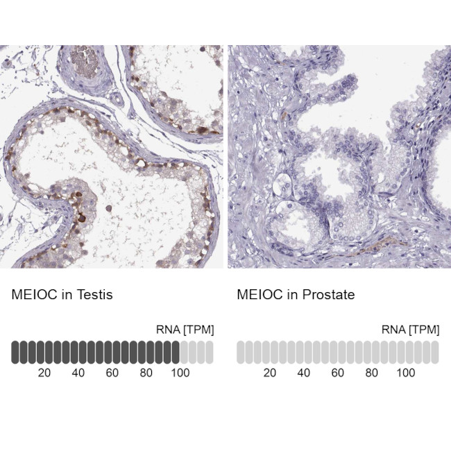 C17orf104 Antibody in Immunohistochemistry (IHC)