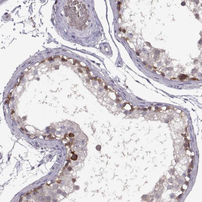 C17orf104 Antibody in Immunohistochemistry (IHC)