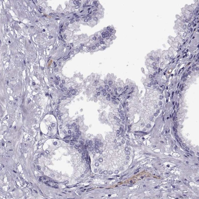 C17orf104 Antibody in Immunohistochemistry (IHC)