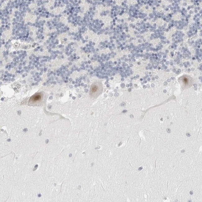 TSEN2 Antibody in Immunohistochemistry (IHC)