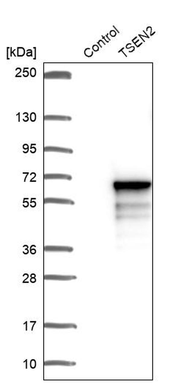 TSEN2 Antibody in Western Blot (WB)