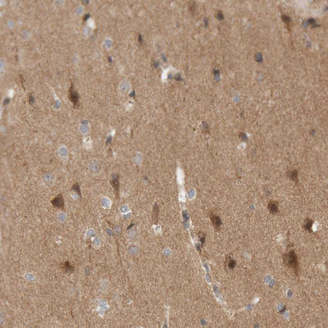 KIF21B Antibody in Immunohistochemistry (IHC)