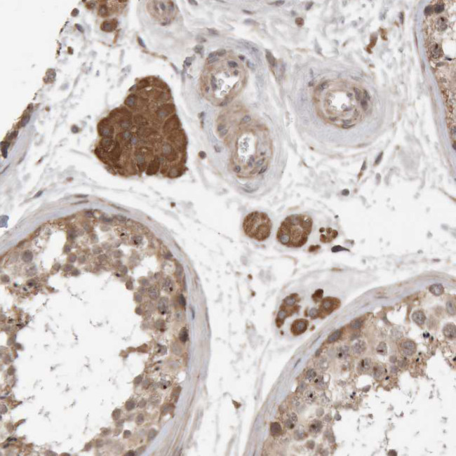 KIF21B Antibody in Immunohistochemistry (IHC)