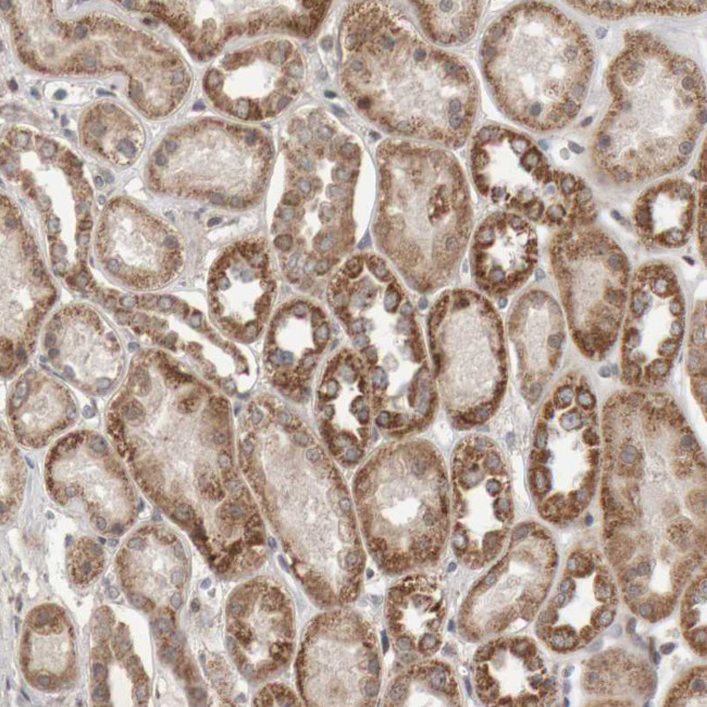 KIF21B Antibody in Immunohistochemistry (IHC)