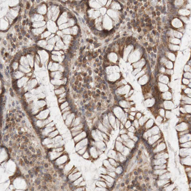 KIF21B Antibody in Immunohistochemistry (IHC)