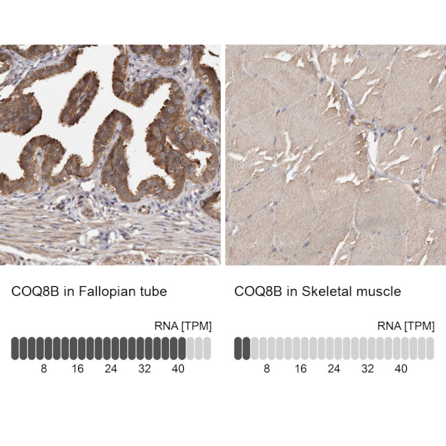 ADCK4 Antibody in Immunohistochemistry (IHC)