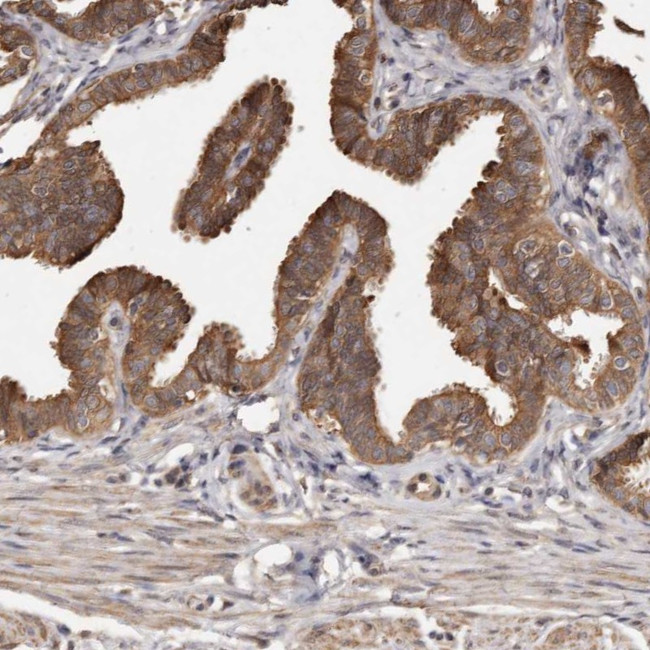 ADCK4 Antibody in Immunohistochemistry (IHC)