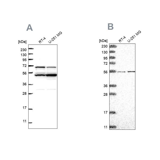 ADCK4 Antibody in Western Blot (WB)