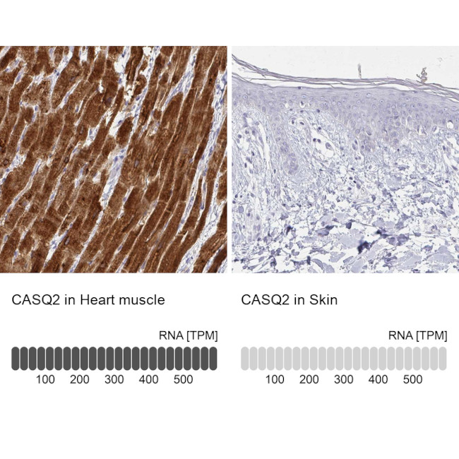 Calsequestrin 2 Antibody in Immunohistochemistry (IHC)