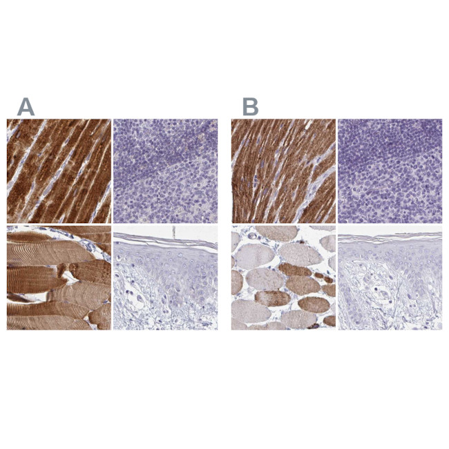 Calsequestrin 2 Antibody in Immunohistochemistry (IHC)