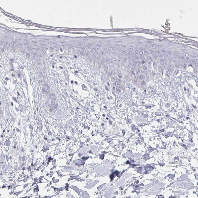 Calsequestrin 2 Antibody in Immunohistochemistry (IHC)