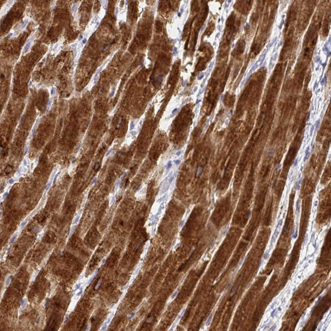 Calsequestrin 2 Antibody in Immunohistochemistry (IHC)