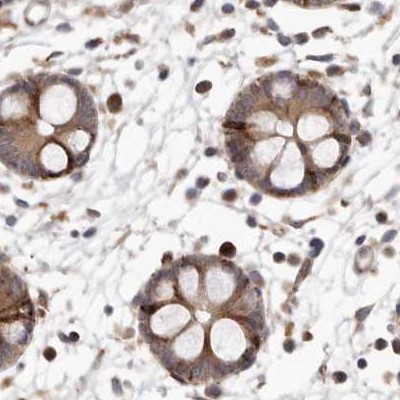 NUP43 Antibody in Immunohistochemistry (IHC)