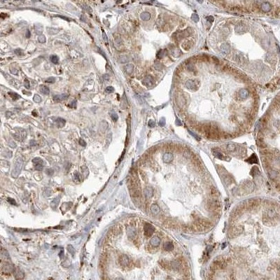 NUP43 Antibody in Immunohistochemistry (IHC)